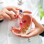 What Causes Stomach Cancer?