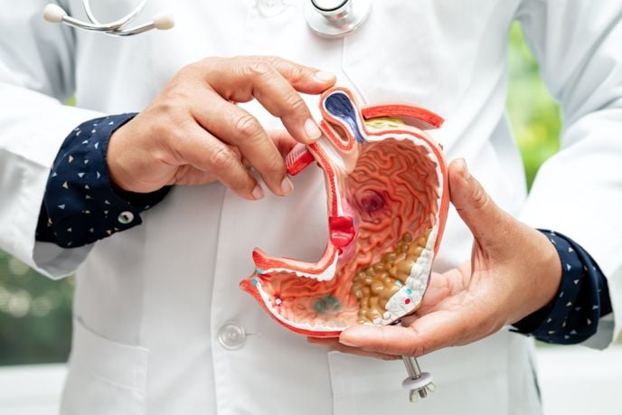 What Causes Stomach Cancer?