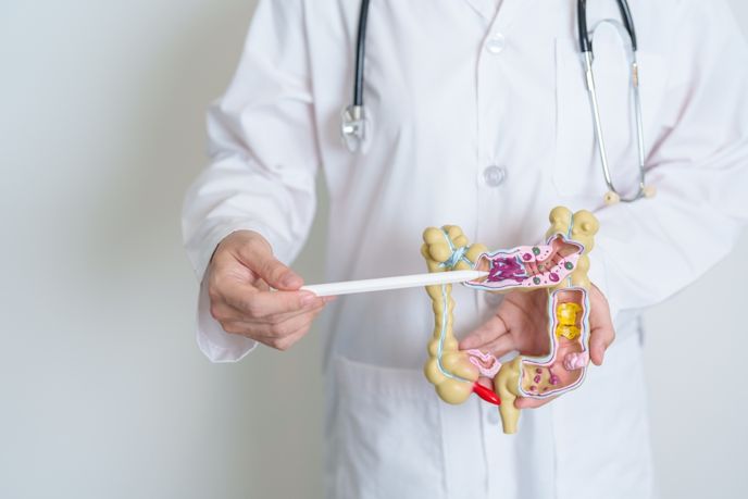 How to Recognize the Symptoms of Colorectal Adenomas