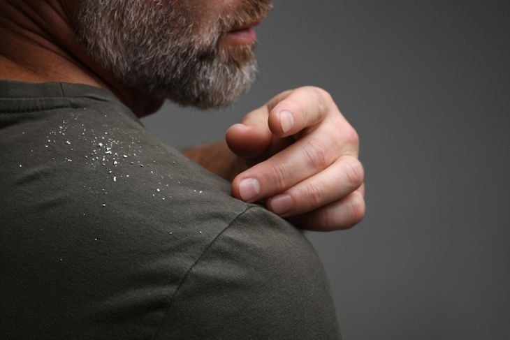A man brushes dandruff flakes from the shoulder of his shirt, demonstrating neem’s common use in hair products to help relieve scalp irritation and reduce flakes. 