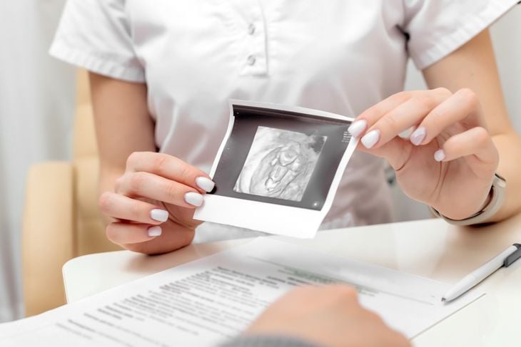 A healthcare professional holds up an ultrasound image, illustrating how ovarian cysts are often detected and monitored during routine exams. 