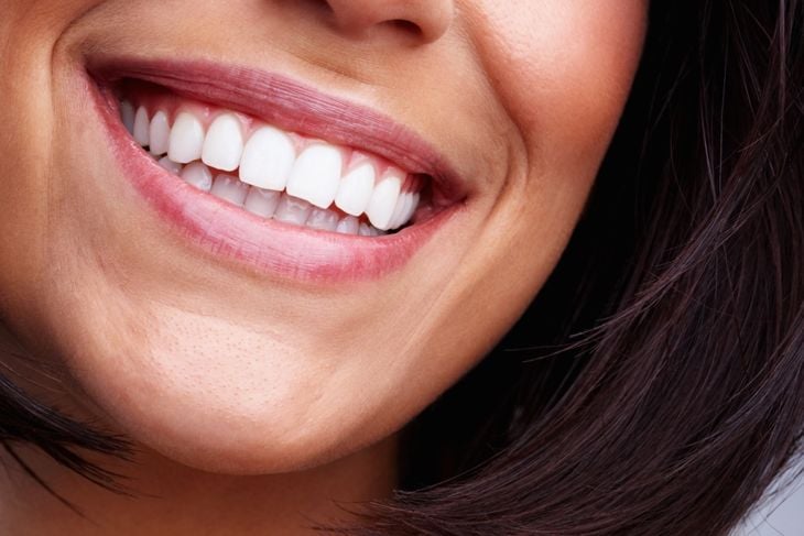 A close-up of a woman’s smile with clean, white teeth, representing neem’s traditional and modern uses in dental care products to support oral health and reduce plaque. 