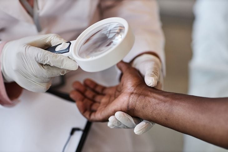 A doctor wearing gloves examines a patient’s forearm with a magnifying glass, highlighting the importance of medical evaluation for cysts that grow, cause pain, or change appearance. 
