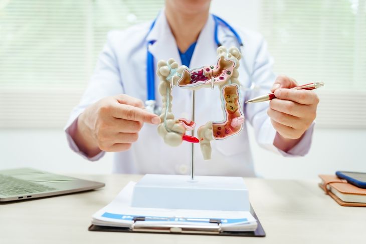 Doctor holding a detailed anatomical model of the human colon, pointing to different sections with both hands. The setting suggests a clinical explanation or discussion related to colon health and treatment.