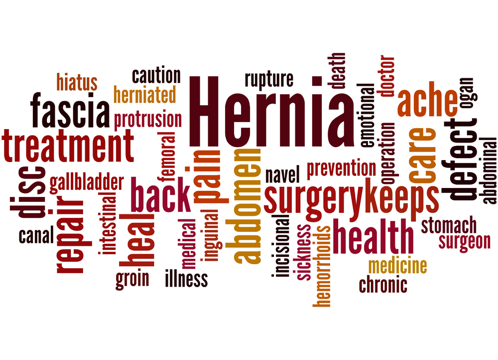 10 Symptoms Of Sports Hernia Facty Health 429