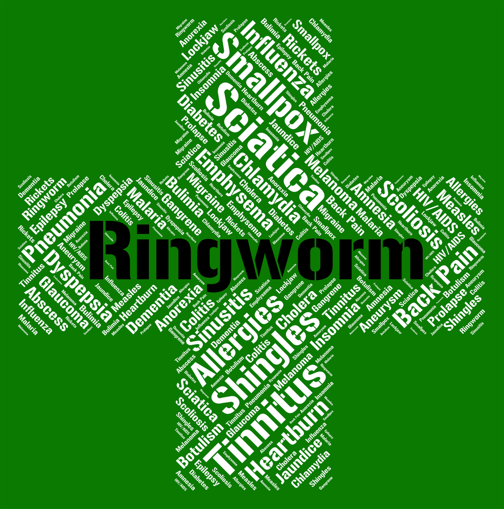 10 Treatments for Ringworm Facty Health