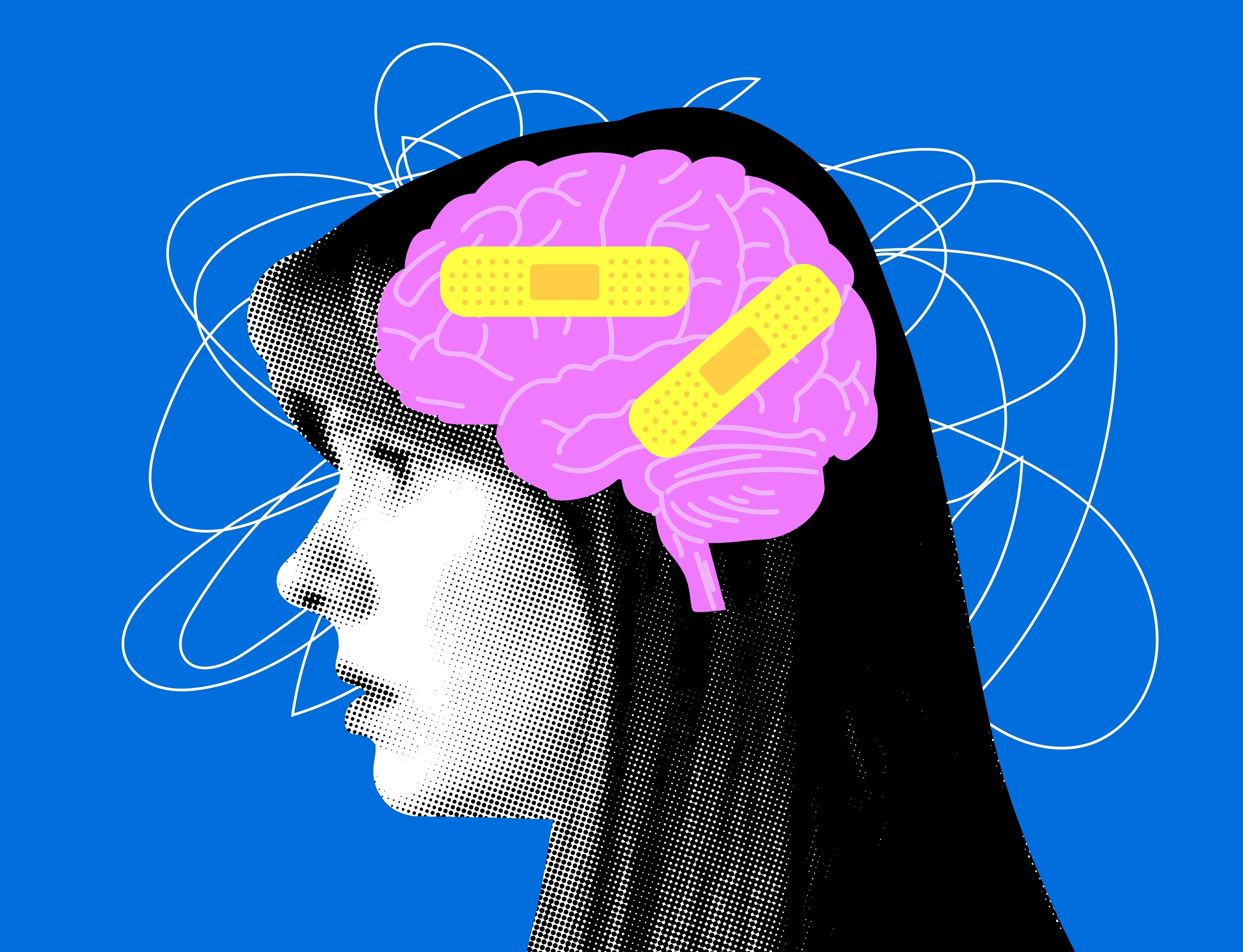 Modern collage with female head and brain covered with plaster bandage.