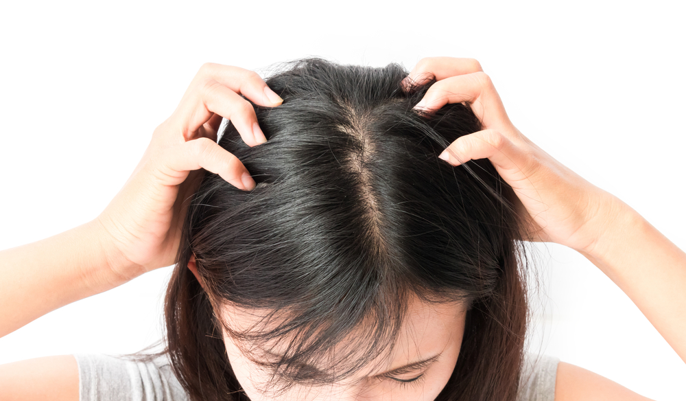10 Symptoms of Head Lice Facty Health