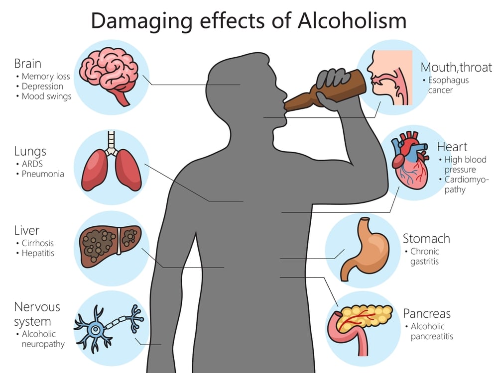 harmful effects of alcohol on the human body diagram schematic raster illustration. Medical science educational illustration