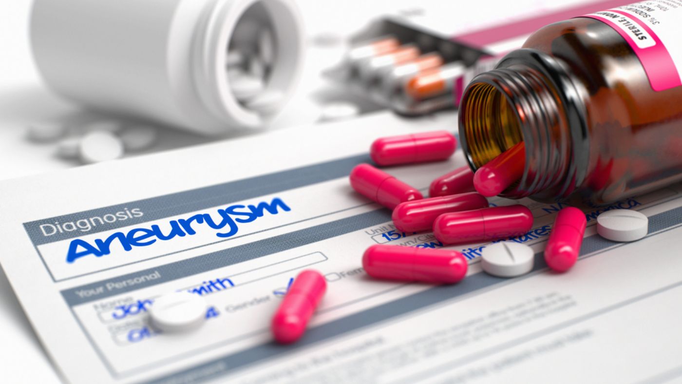Understanding Aneurysms: 10 Symptoms to Be Aware Of - Facty Health