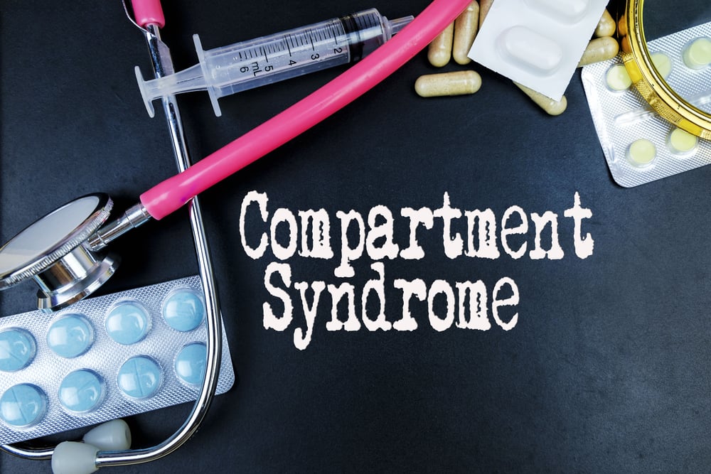 Treatments for Compartment Syndrome Facty Health