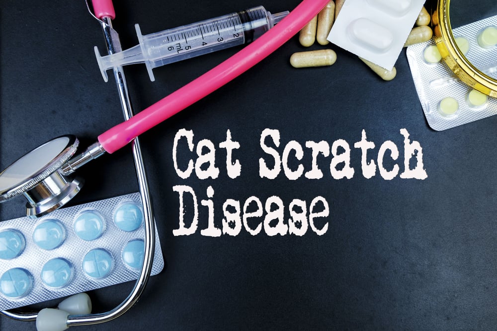 10 Symptoms and Treatments for CatScratch Disease Facty Health
