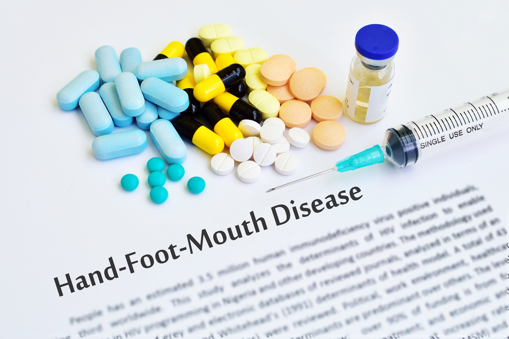 10 Causes, Symptoms, and Treatments of HandFootandMouth Disease Facty Health