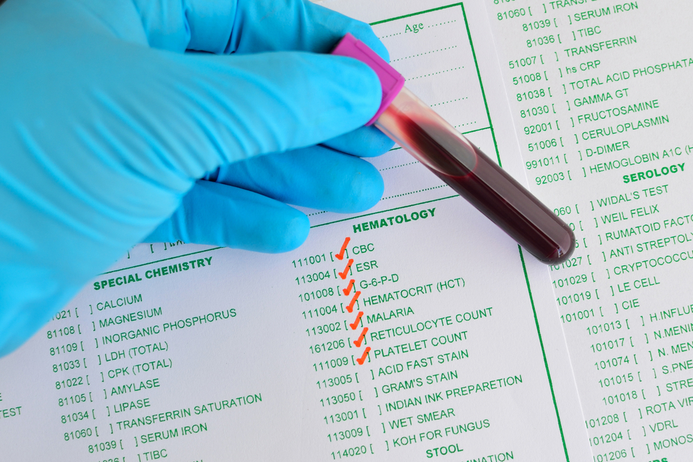 What is an ESR Test? Facty Health