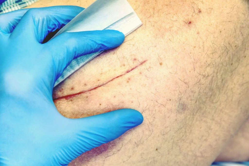 10 Surprising Health Benefits of Zinc Oxide Facty Health