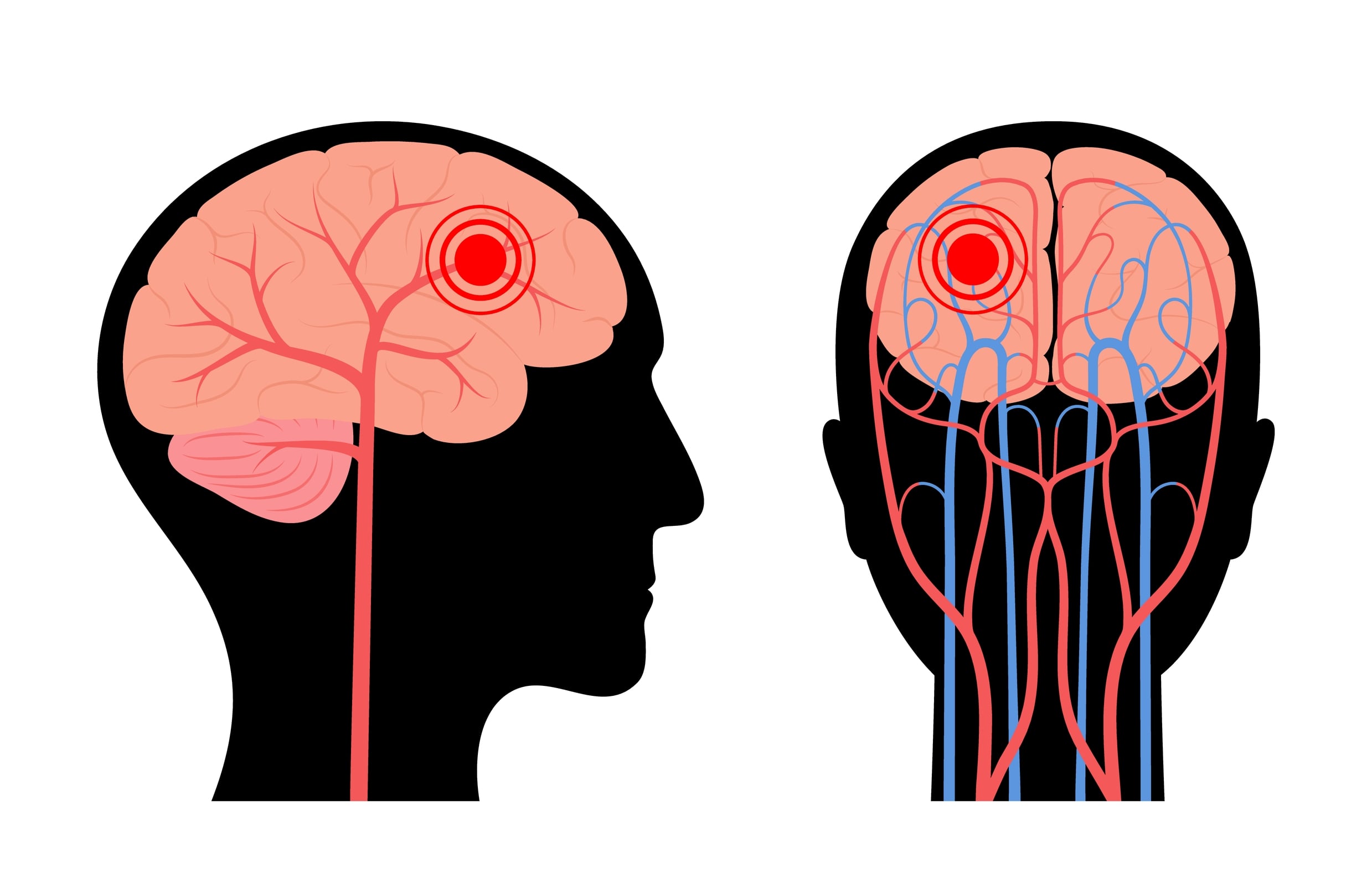 Pain in human head