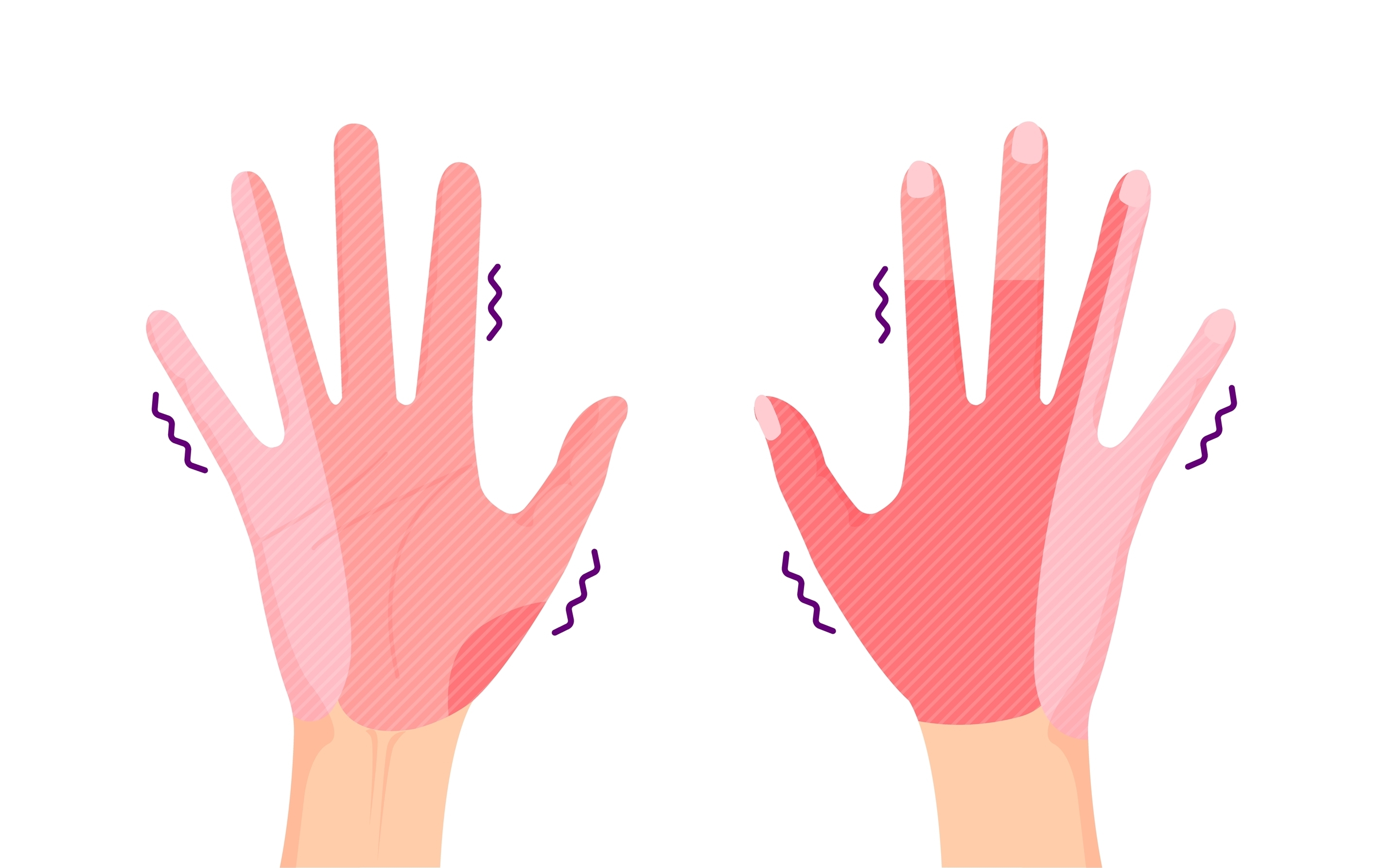 Range of hand numbness