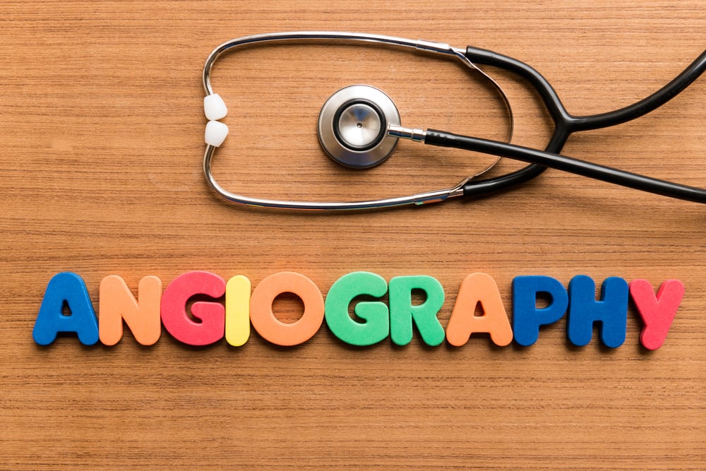What You Should Know About Angiography - Facty Health
