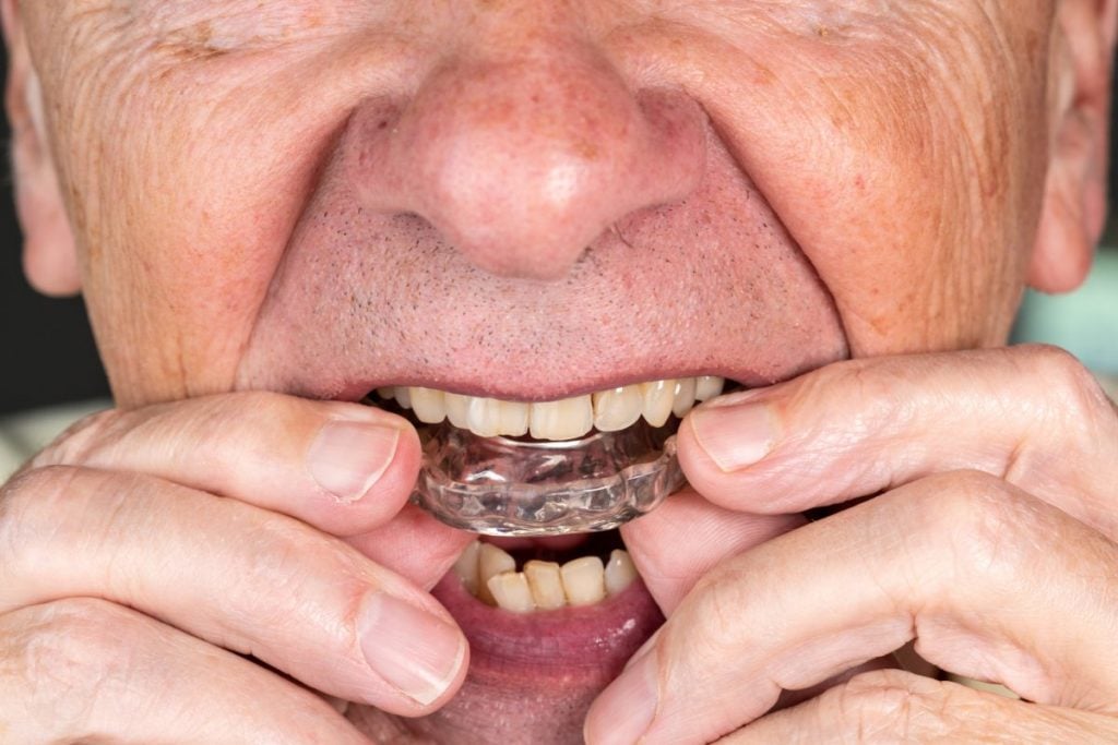 What Is Bruxism? Facty Health
