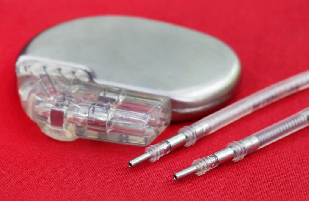 How Do Pacemakers Work? Facty Health