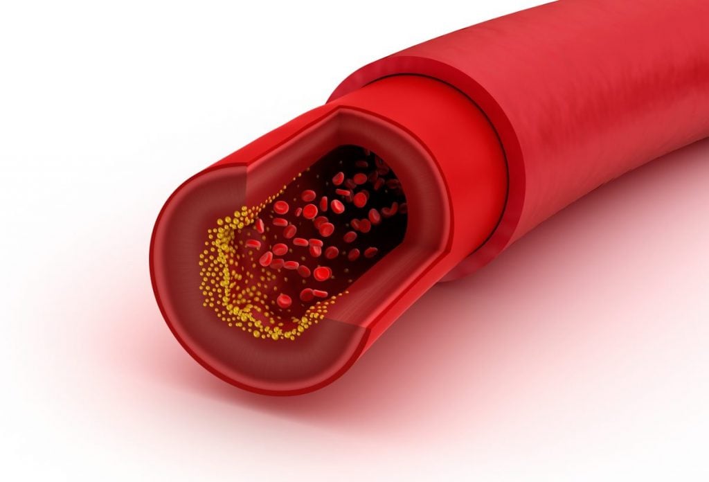 What Are Arteries? - Facty Health