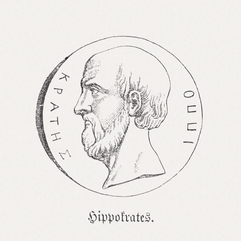 The Historical Practice of Bloodletting Facty Health