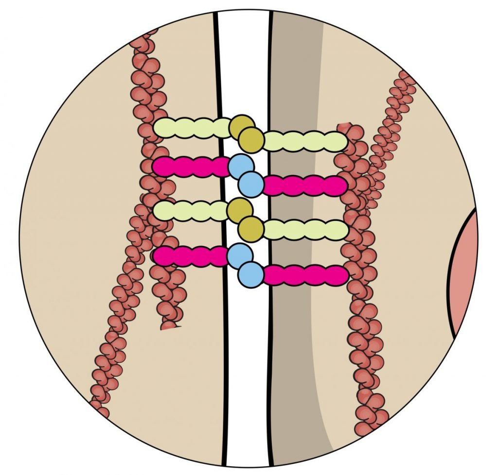 What is FitzHughCurtis Syndrome Facty Health