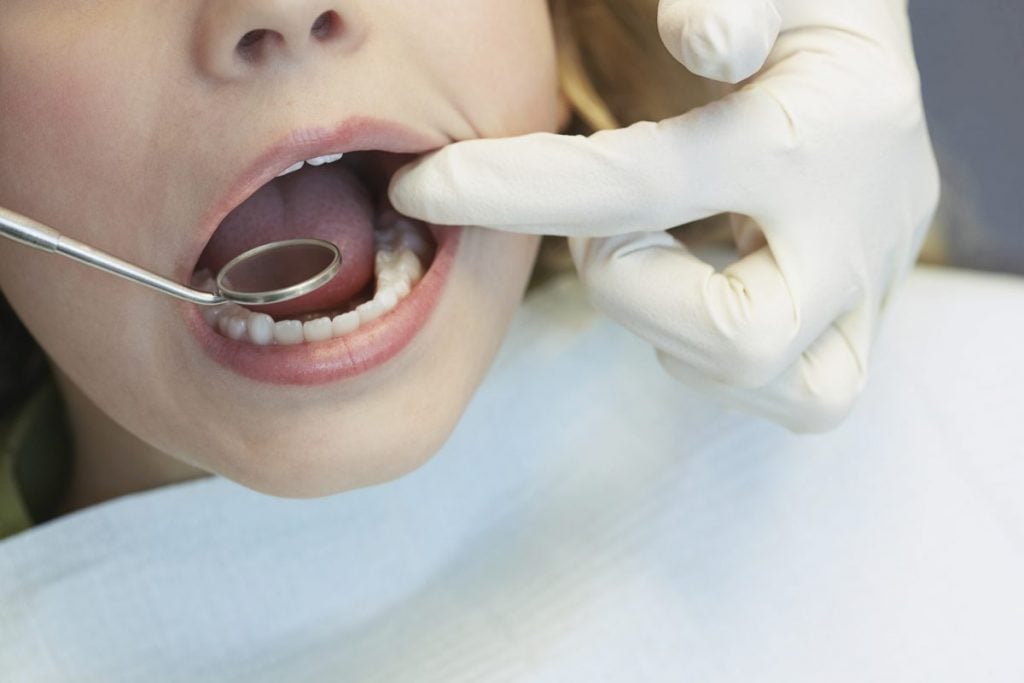 What is Ankyloglossia? - Facty Health