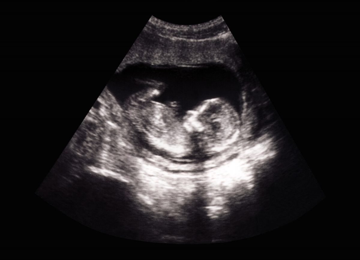 Ultrasound Explained Facty Health