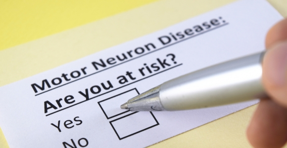 What is Motor Neuron Disease? Facty Health