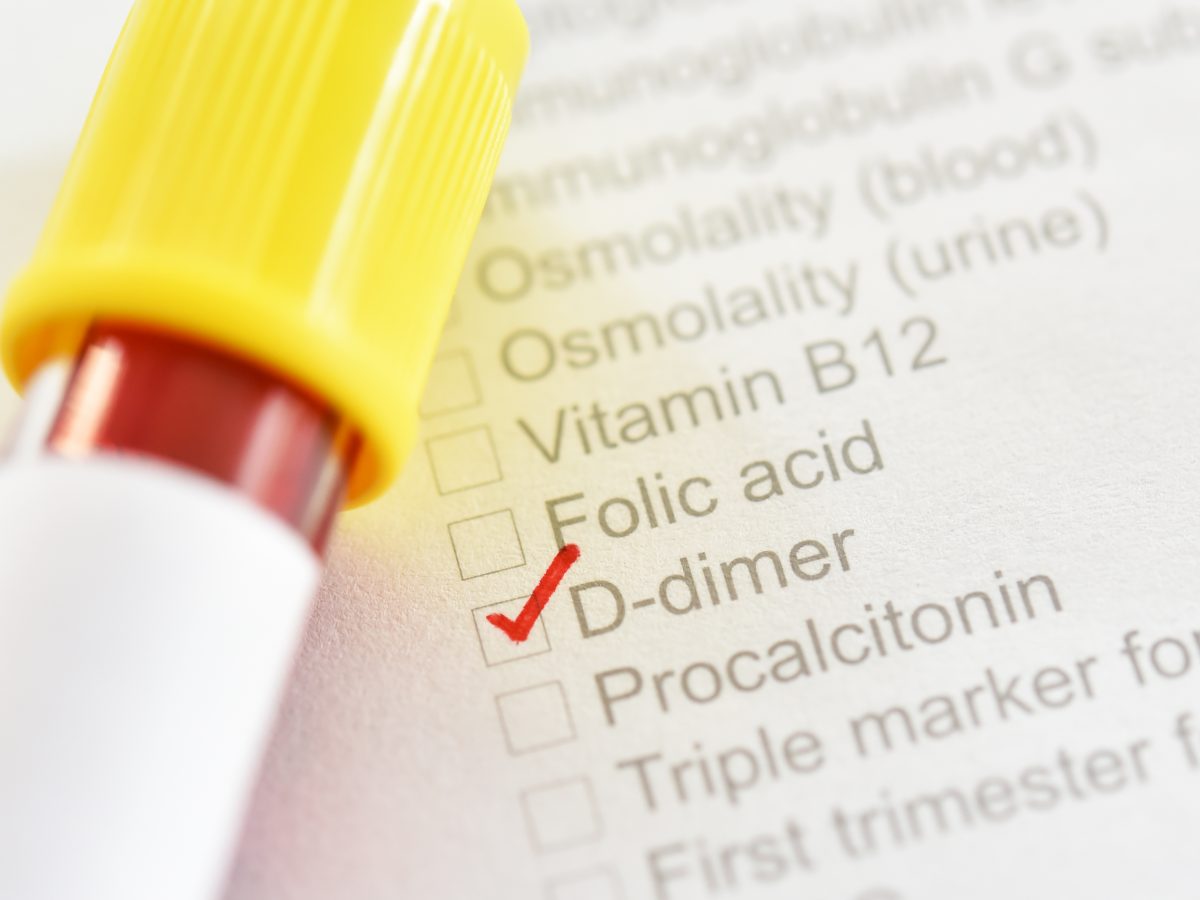 The Catatonic State What Is Catatonia? Facty Health