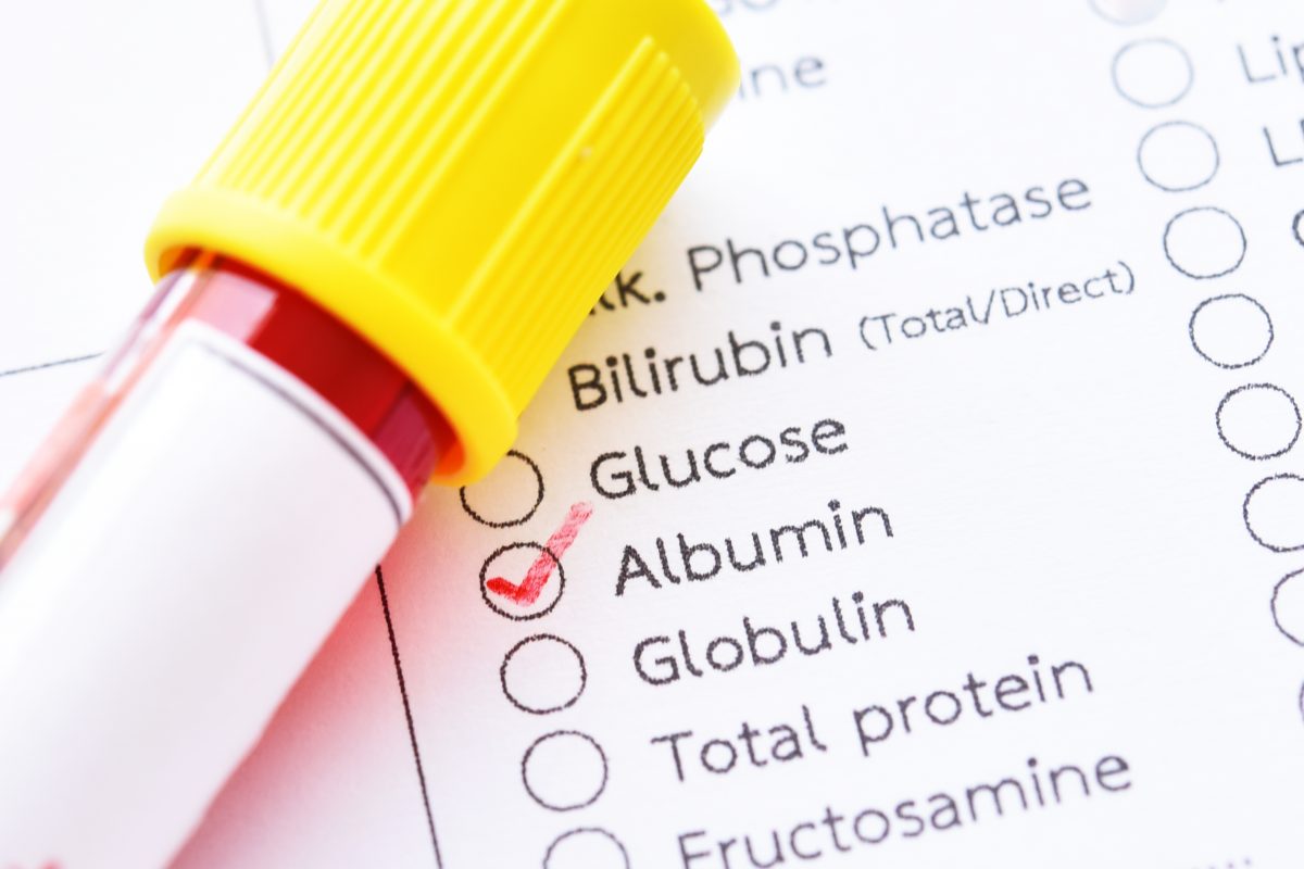 Parts of the Blood: What is Plasma? - Facty Health