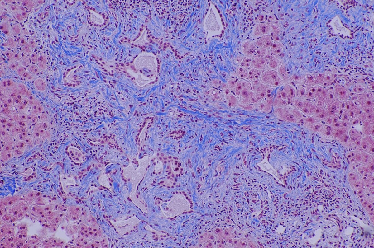 14 Health Benefits of Marshmallow Root Facty Health