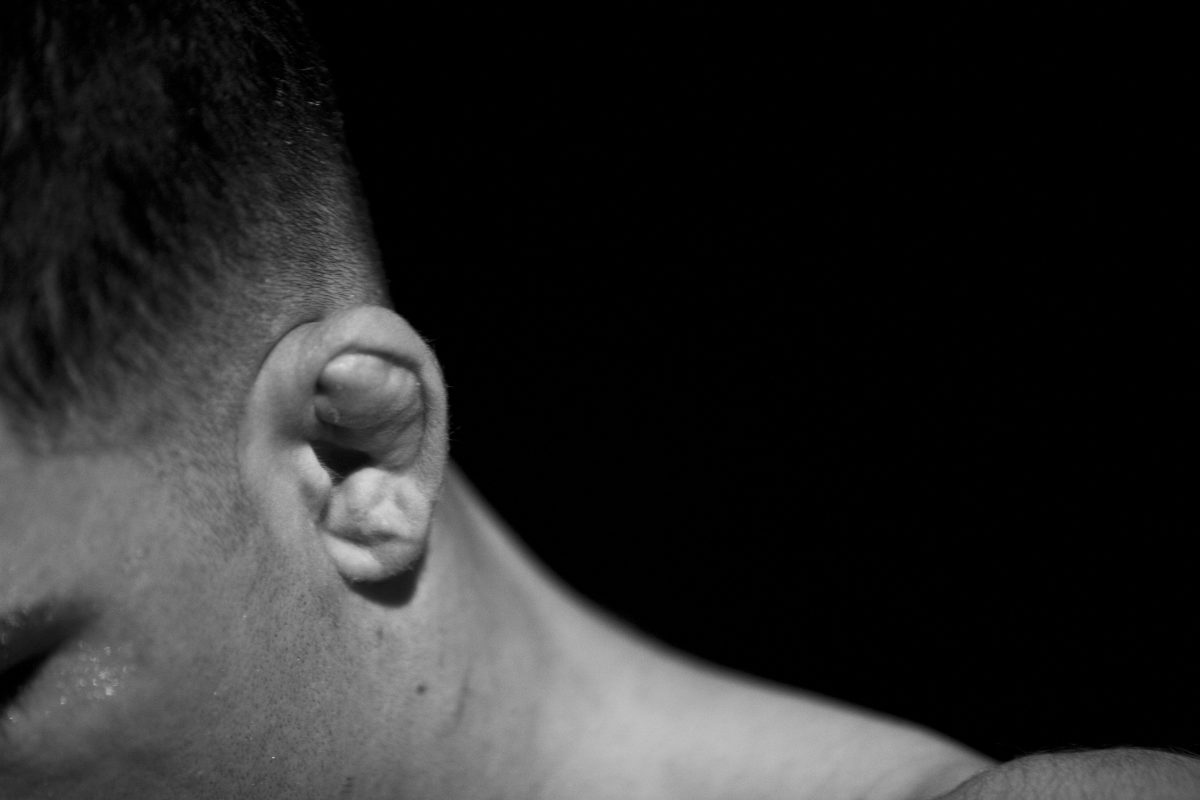 Causes and Treatments for Cauliflower Ear Facty Health