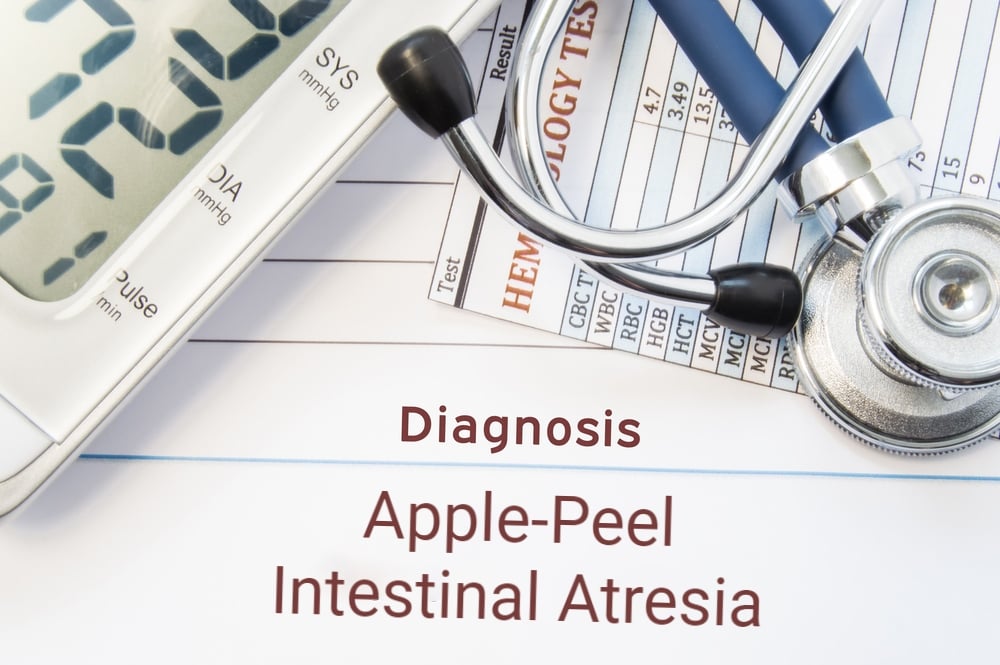 and Stromme Syndrome Facty Health