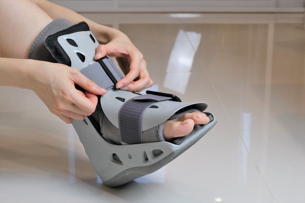 overview-of-jones-fractures-on-the-foot-facty-health