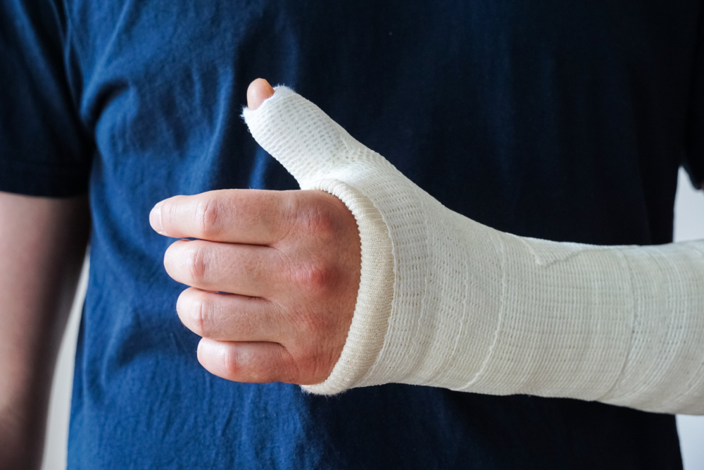 Diagnosing and Treating a Colles Fracture Facty Health